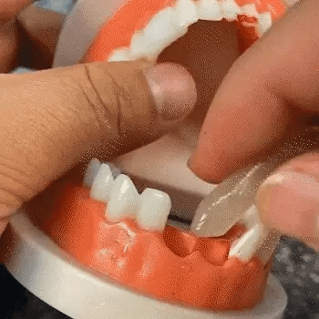 False Teeth™ Masilla Para Dientes Temporales